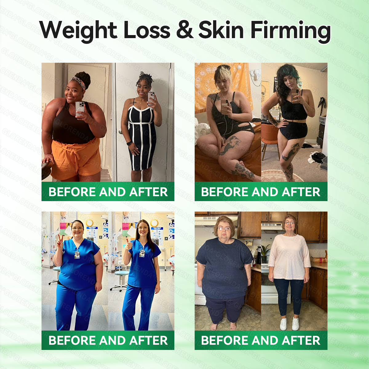 𝑶𝒇𝒇𝒊𝒄𝒊𝒂𝒍 𝑺𝒕𝒐𝒓𝒆  | 🥑𝐆𝐋𝐎𝑹𝑬𝑵𝑫𝗔®𝑴𝒐𝒓𝒊𝒏𝒈𝗮 · 𝗕𝗲𝗿𝗯𝗲𝗿𝙞𝙣𝙚 × 𝙉𝘼𝐃+ 𝟏𝟎-𝐢𝐧-𝟏 𝗔𝗱𝘃𝗮𝗻𝗰𝙚𝙙 𝙉𝙖𝙣𝙤 𝙈𝙞𝙘𝙧𝙤𝙣𝙚𝙚𝐝𝐥𝐞 𝐏𝐚𝐭𝙘𝙝🇺🇸(𝐉𝐮𝐬𝐭 𝐨𝐧𝐜𝐞 𝐚 𝐝𝐚𝐲, 𝐯𝐢𝐬𝐢𝐛𝐥𝐞 𝐜𝐡𝐚𝐧𝐠𝐞𝐬 𝐢𝐧 𝟕 𝐝𝐚𝐲𝐬） ✅ 𝐅𝐨𝐫 𝐨𝐛𝐞𝐬𝐢𝐭𝐲, 🅛🅞🅞🅢🅔 🅢🅚🅘🅝,𝐝𝐢𝐚𝐛𝐞𝐭𝐞𝐬, 𝐬𝐥𝐞𝐞𝐩 𝐚𝐩𝐧𝐞𝐚, 𝐣𝐨𝐢𝐧𝐭 𝐢𝐬𝐬𝐮𝐞𝐬, 𝐚𝐧𝐝 𝐦𝐨𝐫𝐞