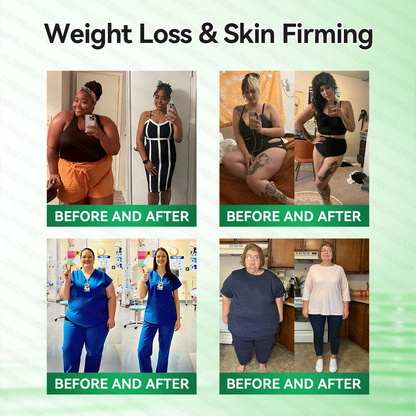 𝑶𝒇𝒇𝒊𝒄𝒊𝒂𝒍 𝑺𝒕𝒐𝒓𝒆  | 🥑𝐆𝐋𝐎𝑹𝑬𝑵𝑫𝗔®𝑴𝒐𝒓𝒊𝒏𝒈𝗮 · 𝗕𝗲𝗿𝗯𝗲𝗿𝙞𝙣𝙚 × 𝙉𝘼𝐃+ 𝟏𝟎-𝐢𝐧-𝟏 𝗔𝗱𝘃𝗮𝗻𝗰𝙚𝙙 𝙉𝙖𝙣𝙤 𝙈𝙞𝙘𝙧𝙤𝙣𝙚𝙚𝐝𝐥𝐞 𝐏𝐚𝐭𝙘𝙝🇺🇸(𝐉𝐮𝐬𝐭 𝐨𝐧𝐜𝐞 𝐚 𝐝𝐚𝐲, 𝐯𝐢𝐬𝐢𝐛𝐥𝐞 𝐜𝐡𝐚𝐧𝐠𝐞𝐬 𝐢𝐧 𝟕 𝐝𝐚𝐲𝐬） ✅ 𝐅𝐨𝐫 𝐨𝐛𝐞𝐬𝐢𝐭𝐲, 🅛🅞🅞🅢🅔 🅢🅚🅘🅝,𝐝𝐢𝐚𝐛𝐞𝐭𝐞𝐬, 𝐬𝐥𝐞𝐞𝐩 𝐚𝐩𝐧𝐞𝐚, 𝐣𝐨𝐢𝐧𝐭 𝐢𝐬𝐬𝐮𝐞𝐬, 𝐚𝐧𝐝 𝐦𝐨𝐫𝐞