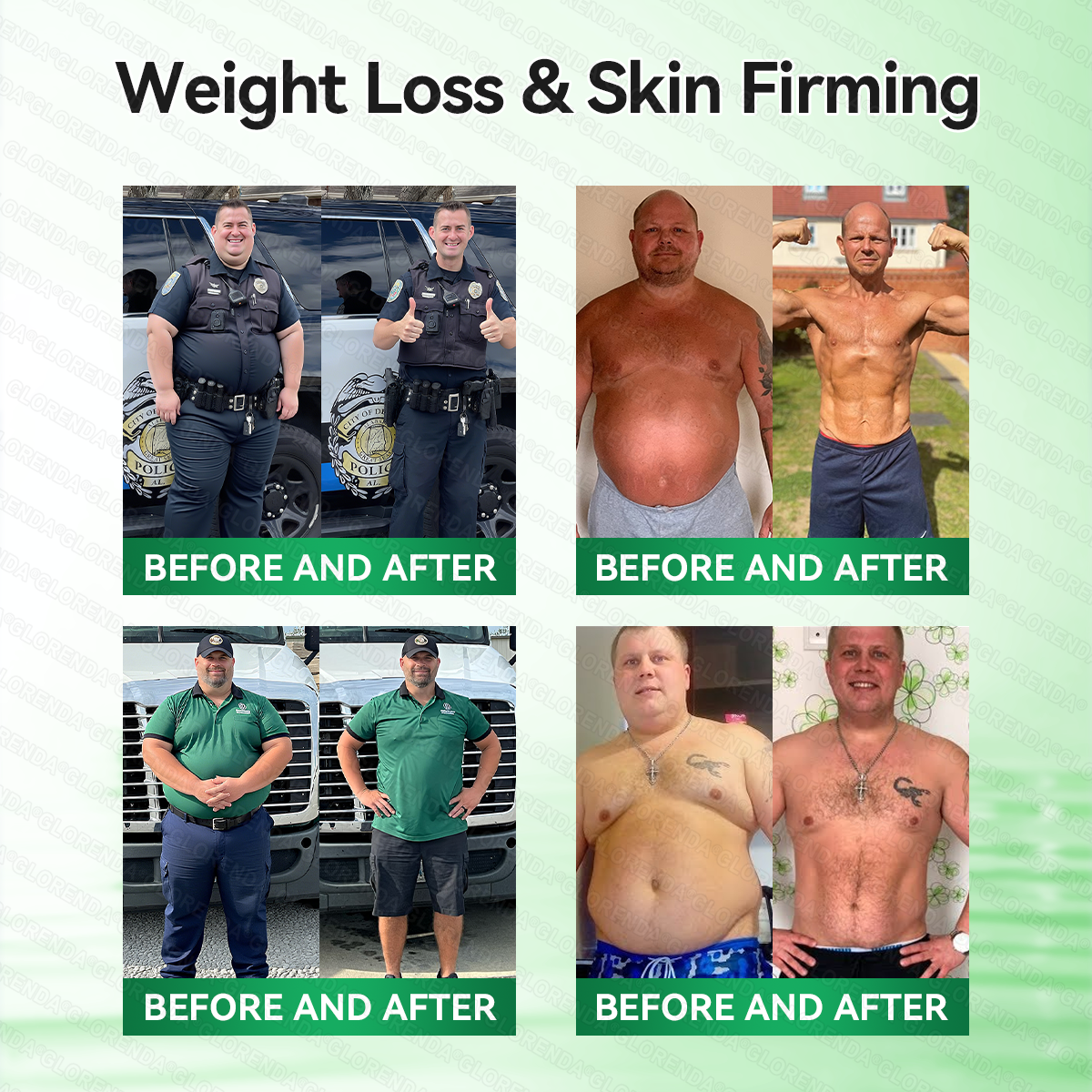 𝑶𝒇𝒇𝒊𝒄𝒊𝒂𝒍 𝑺𝒕𝒐𝒓𝒆  | 🥑𝐆𝐋𝐎𝑹𝑬𝑵𝑫𝗔®𝑴𝒐𝒓𝒊𝒏𝒈𝗮 · 𝗕𝗲𝗿𝗯𝗲𝗿𝙞𝙣𝙚 × 𝙉𝘼𝐃+ 𝟏𝟎-𝐢𝐧-𝟏 𝗔𝗱𝘃𝗮𝗻𝗰𝙚𝙙 𝙉𝙖𝙣𝙤 𝙈𝙞𝙘𝙧𝙤𝙣𝙚𝙚𝐝𝐥𝐞 𝐏𝐚𝐭𝙘𝙝🇺🇸(𝐉𝐮𝐬𝐭 𝐨𝐧𝐜𝐞 𝐚 𝐝𝐚𝐲, 𝐯𝐢𝐬𝐢𝐛𝐥𝐞 𝐜𝐡𝐚𝐧𝐠𝐞𝐬 𝐢𝐧 𝟕 𝐝𝐚𝐲𝐬） ✅ 𝐅𝐨𝐫 𝐨𝐛𝐞𝐬𝐢𝐭𝐲, 🅛🅞🅞🅢🅔 🅢🅚🅘🅝,𝐝𝐢𝐚𝐛𝐞𝐭𝐞𝐬, 𝐬𝐥𝐞𝐞𝐩 𝐚𝐩𝐧𝐞𝐚, 𝐣𝐨𝐢𝐧𝐭 𝐢𝐬𝐬𝐮𝐞𝐬, 𝐚𝐧𝐝 𝐦𝐨𝐫𝐞